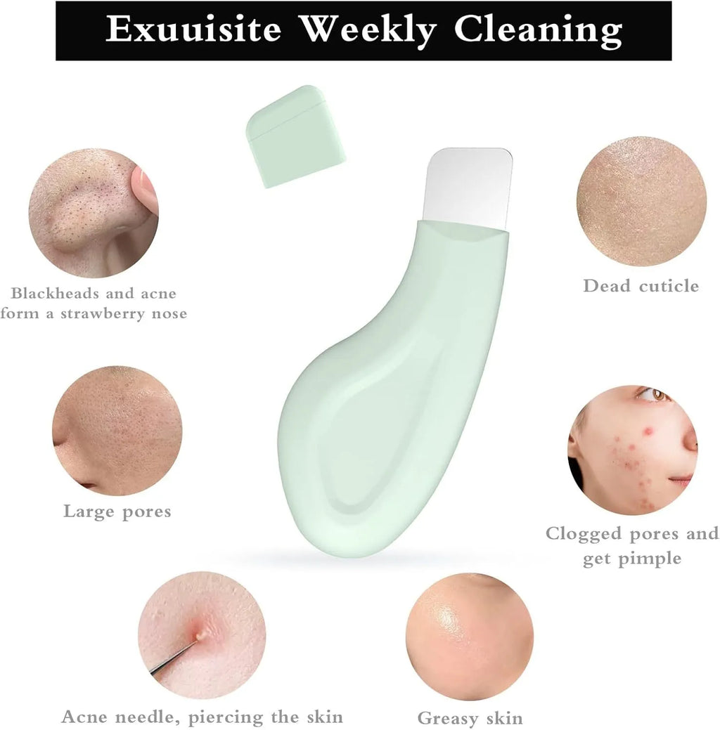Stainless steel blackhead scraper tool with a non-slip handle for facial pore cleaning.