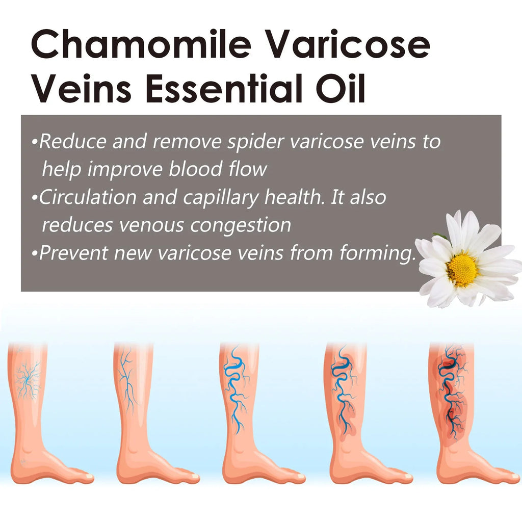 Chamomile leg essential oil bottle containing 10ml of concentrated natural oil for leg skin care