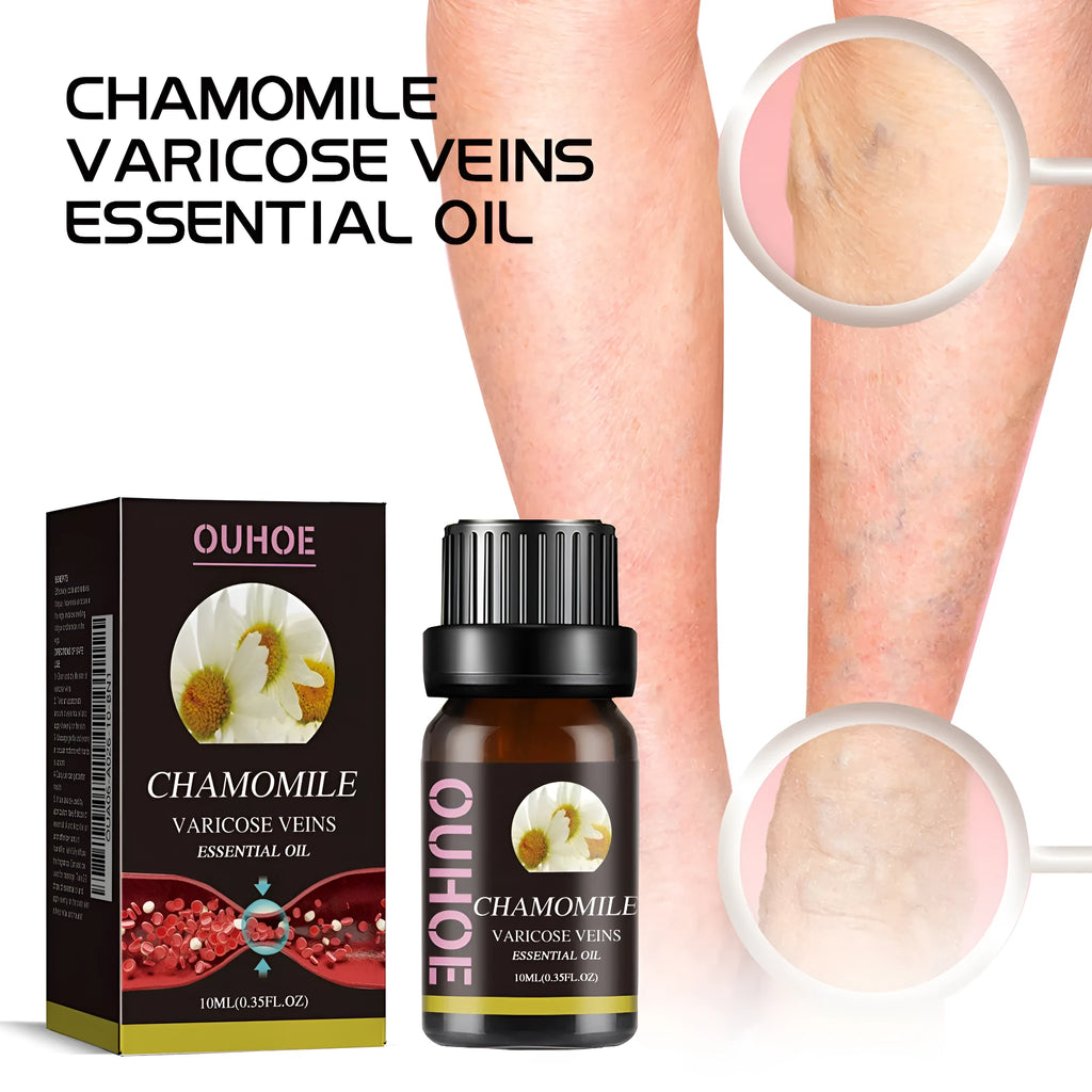 Chamomile leg essential oil bottle containing 10ml of concentrated natural oil for leg skin care