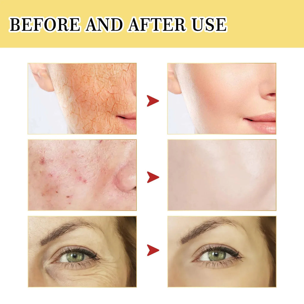 100ml bottle of original formula snail collagen facial serum for hydrating and firming skin.