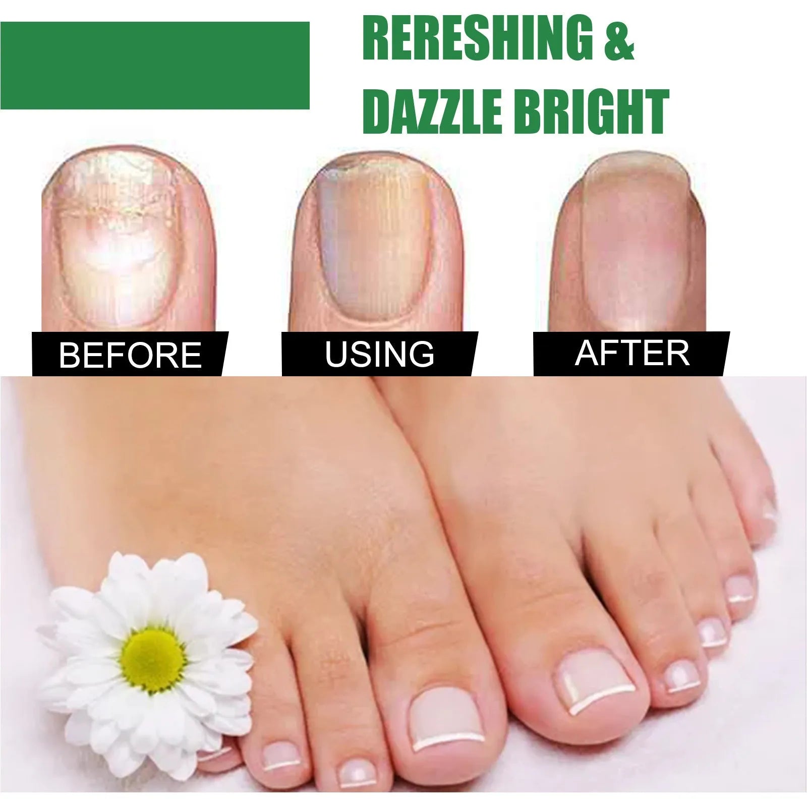 30ml bottle of tea tree oil nail repair solution for hand and foot care