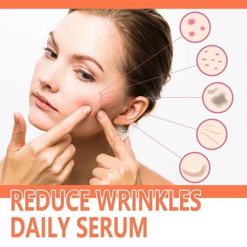 30ml rose essential oil bottle for facial wrinkle care and skin brightening