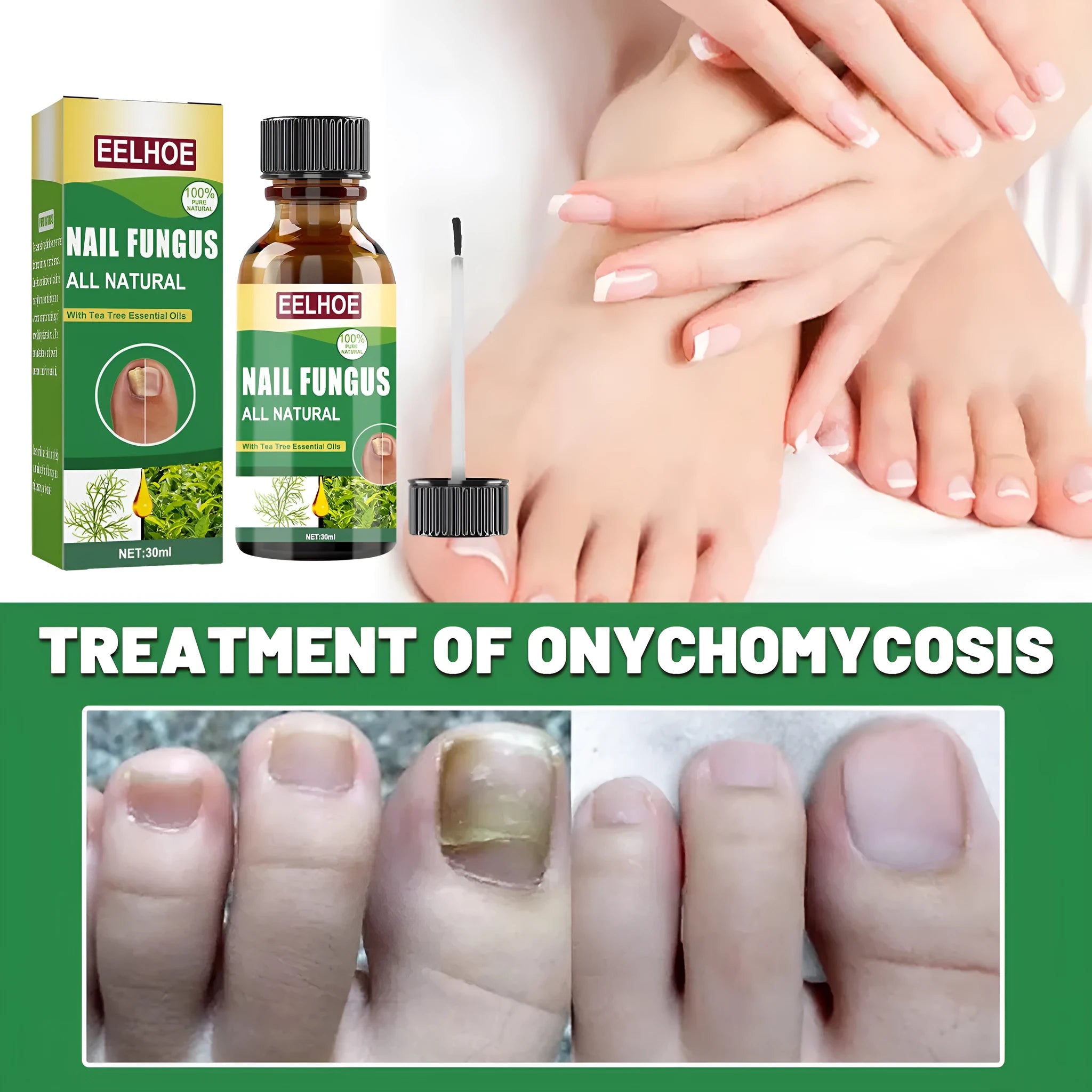 30ml bottle of tea tree oil nail repair solution for hand and foot care