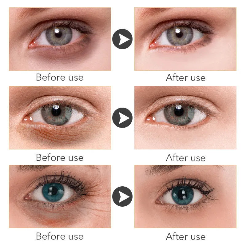 30ml beauty eye cream pot for women's facial skin care routine