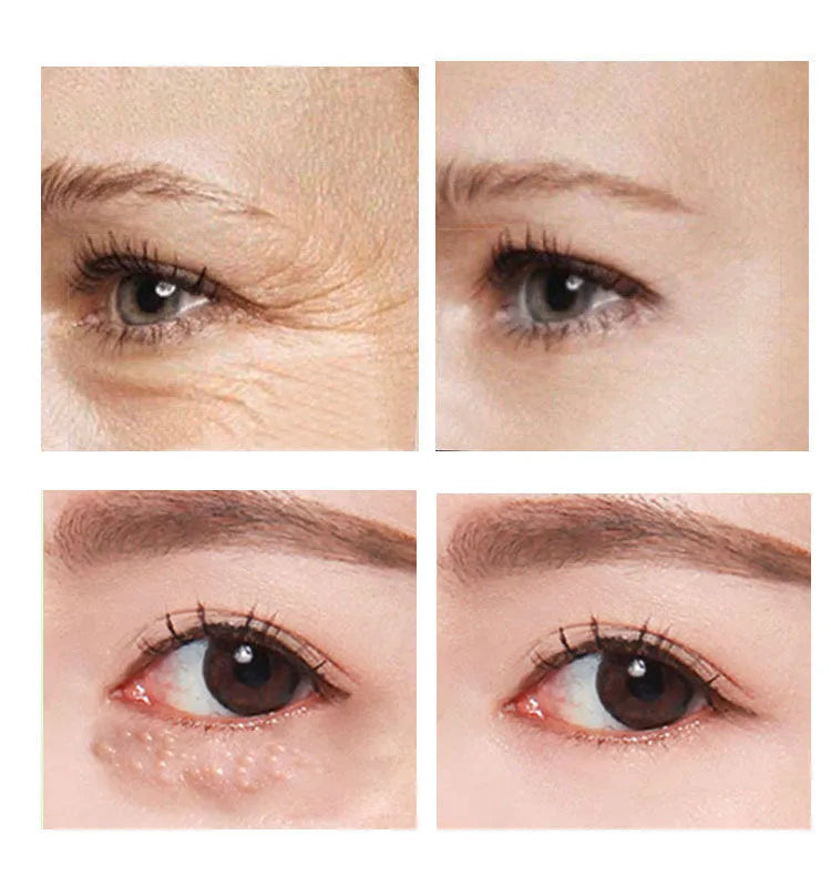 30ml beauty eye cream pot for women's facial skin care routine